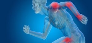 Osteoporose | Causas, Sintomas, Tratamento