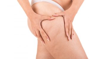 Carboxiterapia,Elimina Gordura Localizada, Estrias e Olheiras