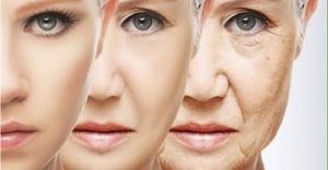 Lifting Facial | Rosto Antes e Depois,Dicas e Recomendações