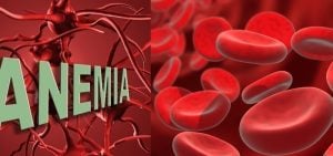 Sintomas de anemia, causas, como tratar e tudo sobre