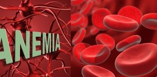 sintomas de anemia