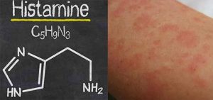 Você tem alergia? Saiba o que a histamina tem a ver com isso!