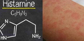 histamina alergia pele
