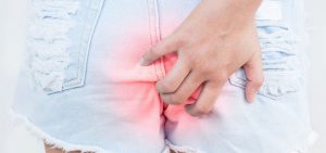 Hemorróidas: causas, tratamentos e prevenção